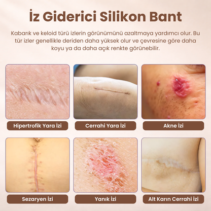 İz Giderici Silikon Bant