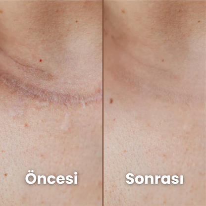 İz Giderici Silikon Bant