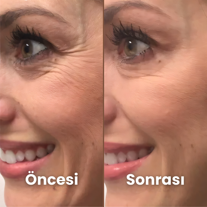 İz Giderici Silikon Bant