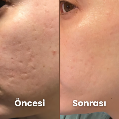 İz Giderici Silikon Bant